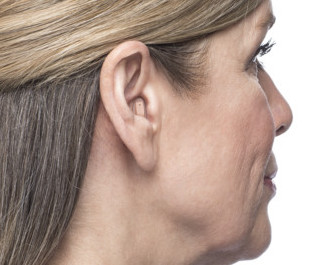 woman with hearing aids