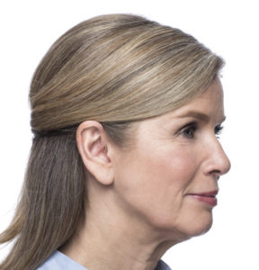 Woman with Micro OTE hearing aid