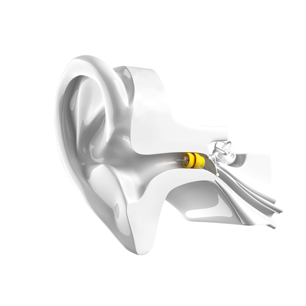Lyric invisible hearing aid