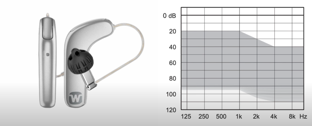 widex smartRIC hearing aid suitability
