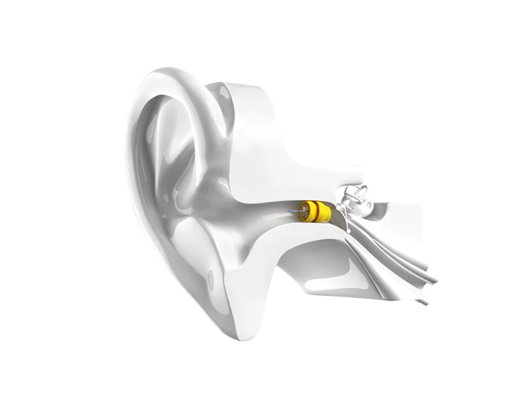 http://phonak%20lyric%20invisible%20hearing%20aid