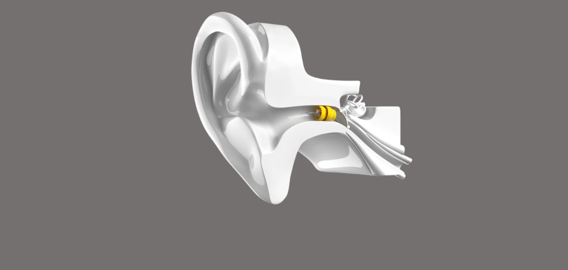 lyric hearing aid