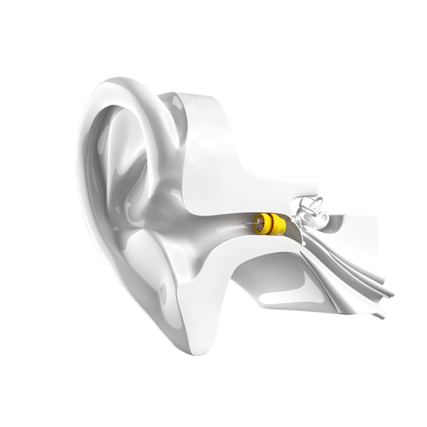 Lyric invisible hearing aid