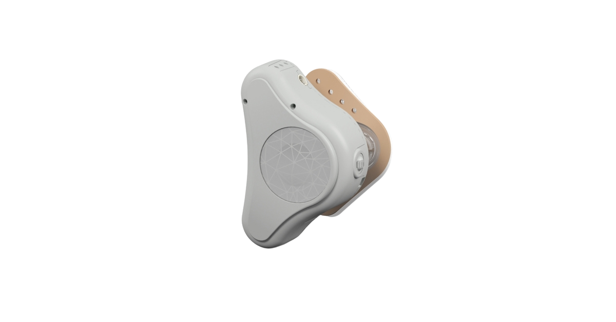 medel adhear bone conduction system