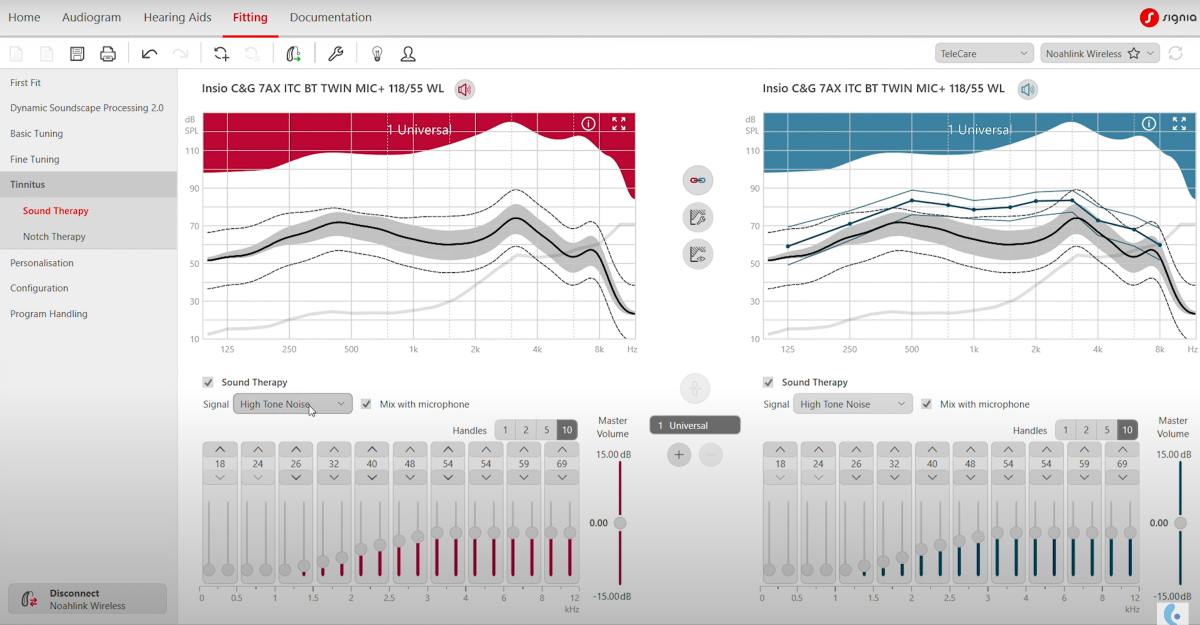 signia ix tinnitus therapy