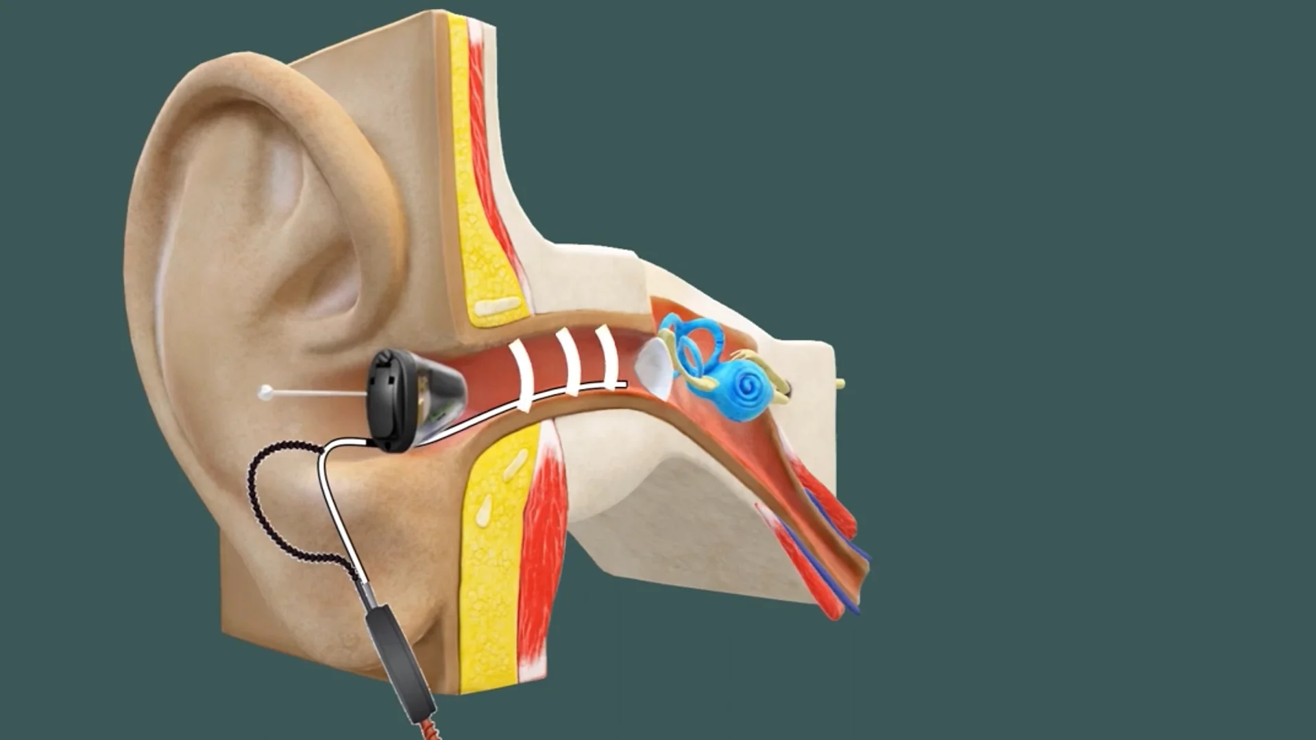 hearing aids with real ear measurements